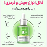 سرم تسکین دهنده قرمزی حاوی 10 درصد اسید آزلائیک و هیالورونیک اسید آنوا کره