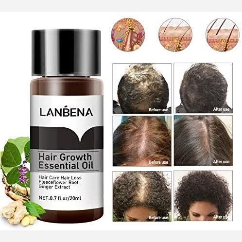 سرم تقویت و افزایش رشد مو لانبنا LANBENA اورجینال20 میل