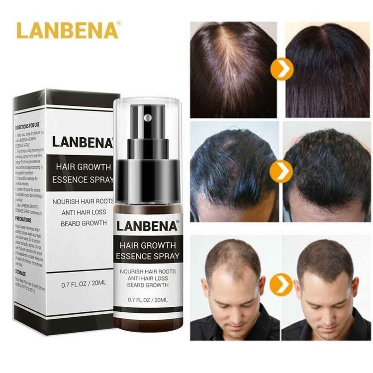 اسپری تقویت و ضدریزش مو لانبنا lanbena