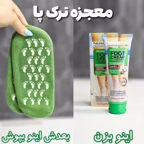 پک ترک پا جوراب سیلیکونی و کرم ترک پا