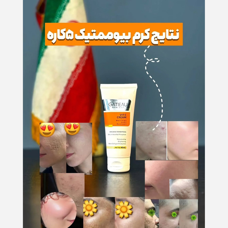 کرم بیوممتیک ضدلک ویتامین سی قوی اصل.